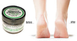 Advanced Clinicals Intensive Dry Foot Exfoliator Peppermint Scrub- 1 fl. ozAdvanced Clinicals Intensive Dry Foot Exfoliator Peppermint Scrub- 1 fl. oz