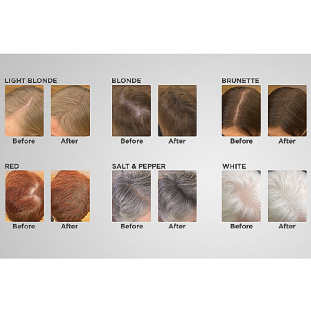 light blonde hair
