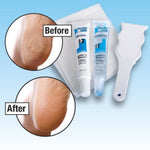 foot callus treatment