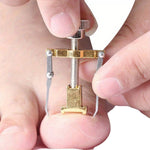 ingrown big toenail fix