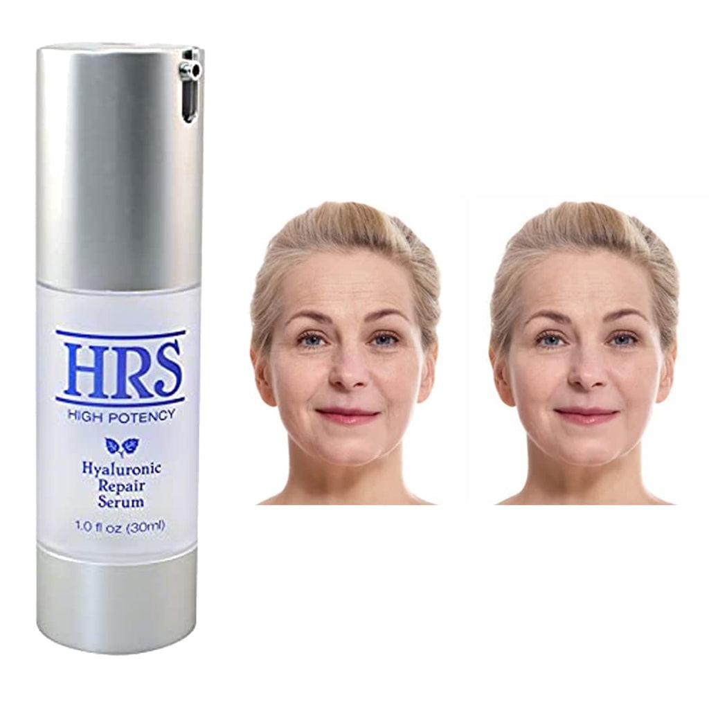 Hyaluronic Repair Concentrate High Potency by BioLogic Solutions (1 fl oz)