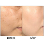 Lumetrics with Copuline by BioLogic Solutions 1 oz.