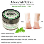 Advanced Clinicals Intensive Dry Foot Exfoliator Peppermint Scrub- 1 fl. oz