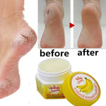 dry cracked feet