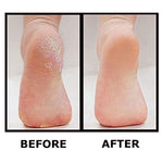 Best Pedicure Foot File - Professional Foot Callus Scrubber