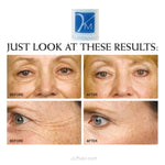 youthful skin