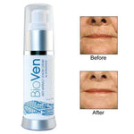 skin cream