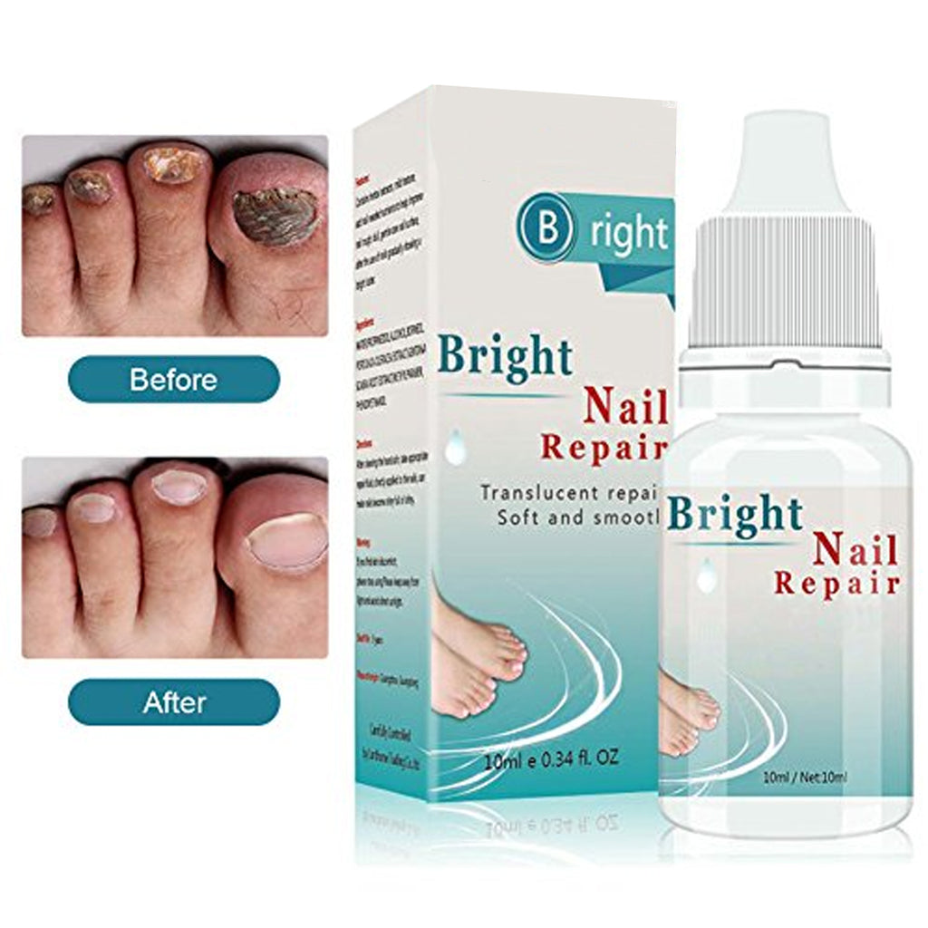 nail infection treatment