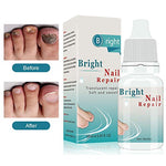 nail infection treatment