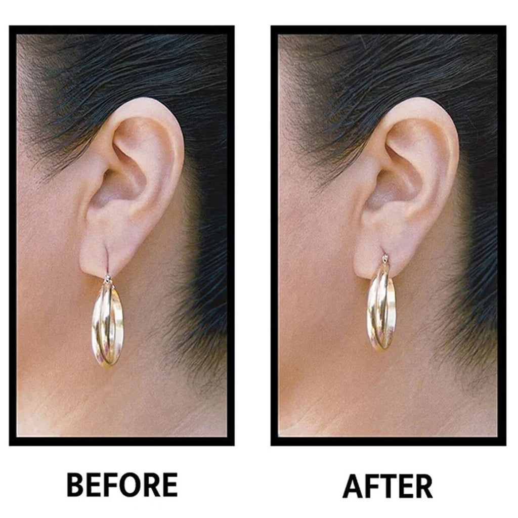 EarLift Invisible Ear Lobe Support Solution