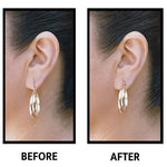EarLift Invisible Ear Lobe Support Solution