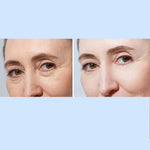 lifting wrinkles
