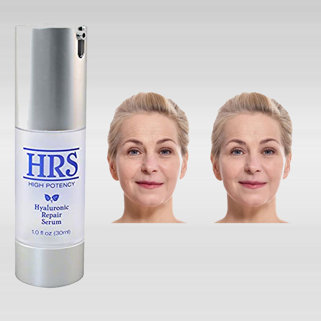 Hyaluronic Repair Concentrate High Potency by BioLogic Solutions (1 fl oz)