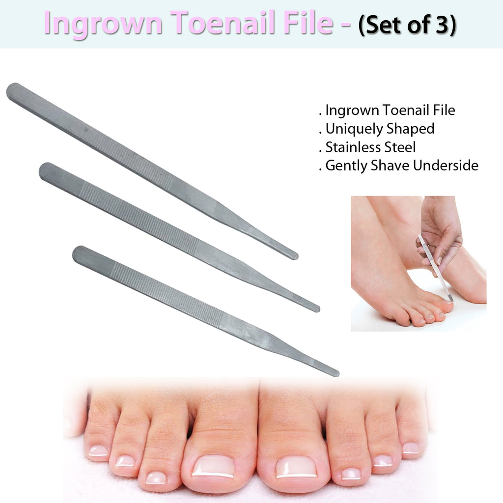 ingrown toenail treatment