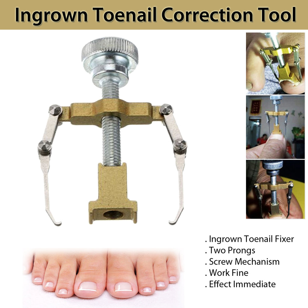 toenail correction
