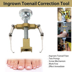 toenail correction