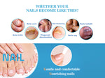 fungal nail treatment