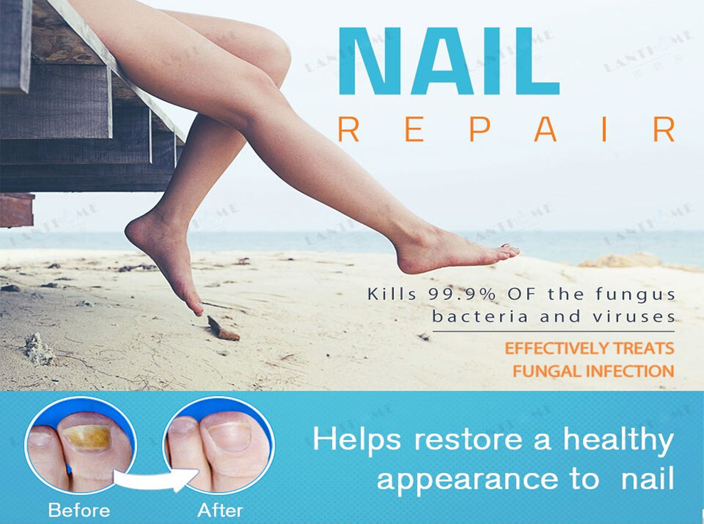 nail repair