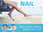 nail repair