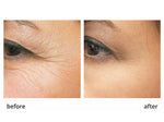 stem cell skin cream