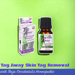 skin tag removal