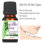 skin tag treatment