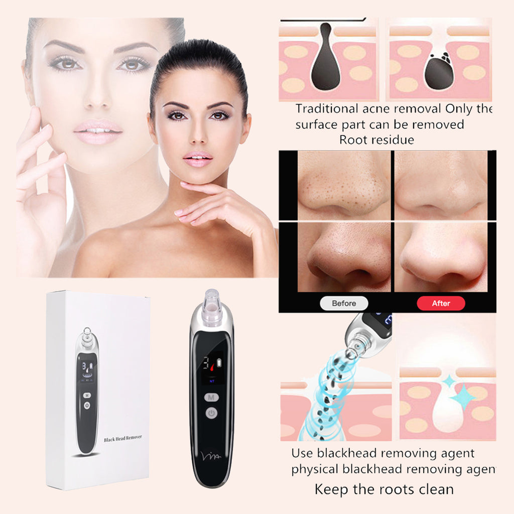 pores on face